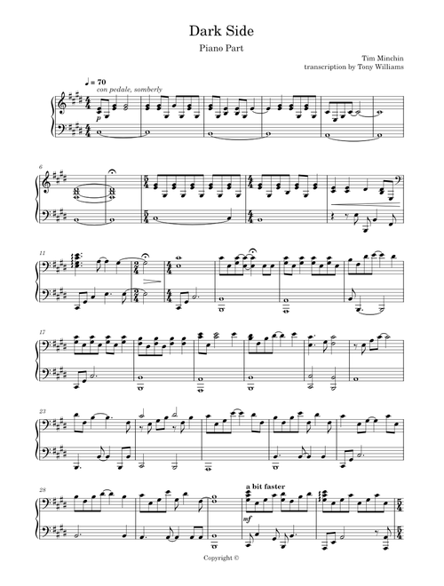 Dark side – Tim Minchin