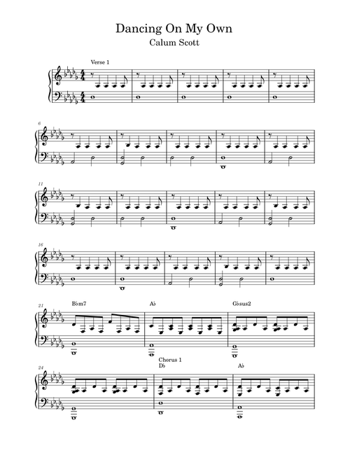 Dancing on my own – Calum Scott Dancing_On_My_Own