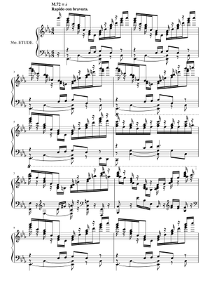 No.45 [scherzo alla napolitana] (第45番 [ナポリ風スケルツォ