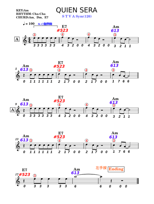 Sway (Quien Sera) – Glee Cast