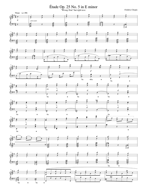 [R] Right note etude (Chopin)