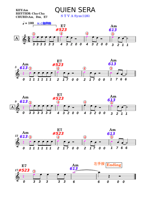 Sway (Quien Sera) – Glee Cast