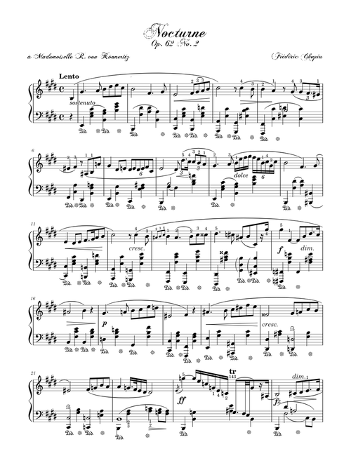 Nocturne Op. 62 No. 2