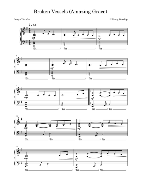 Broken Vessels (Amazing Grace) – Hillsong Worship (Song of Serafin)